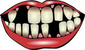 ¿Sabías que la pérdida de dientes tiene relación con las emociones?